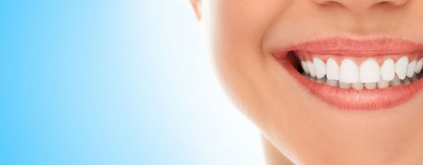 sonrisa-dentista